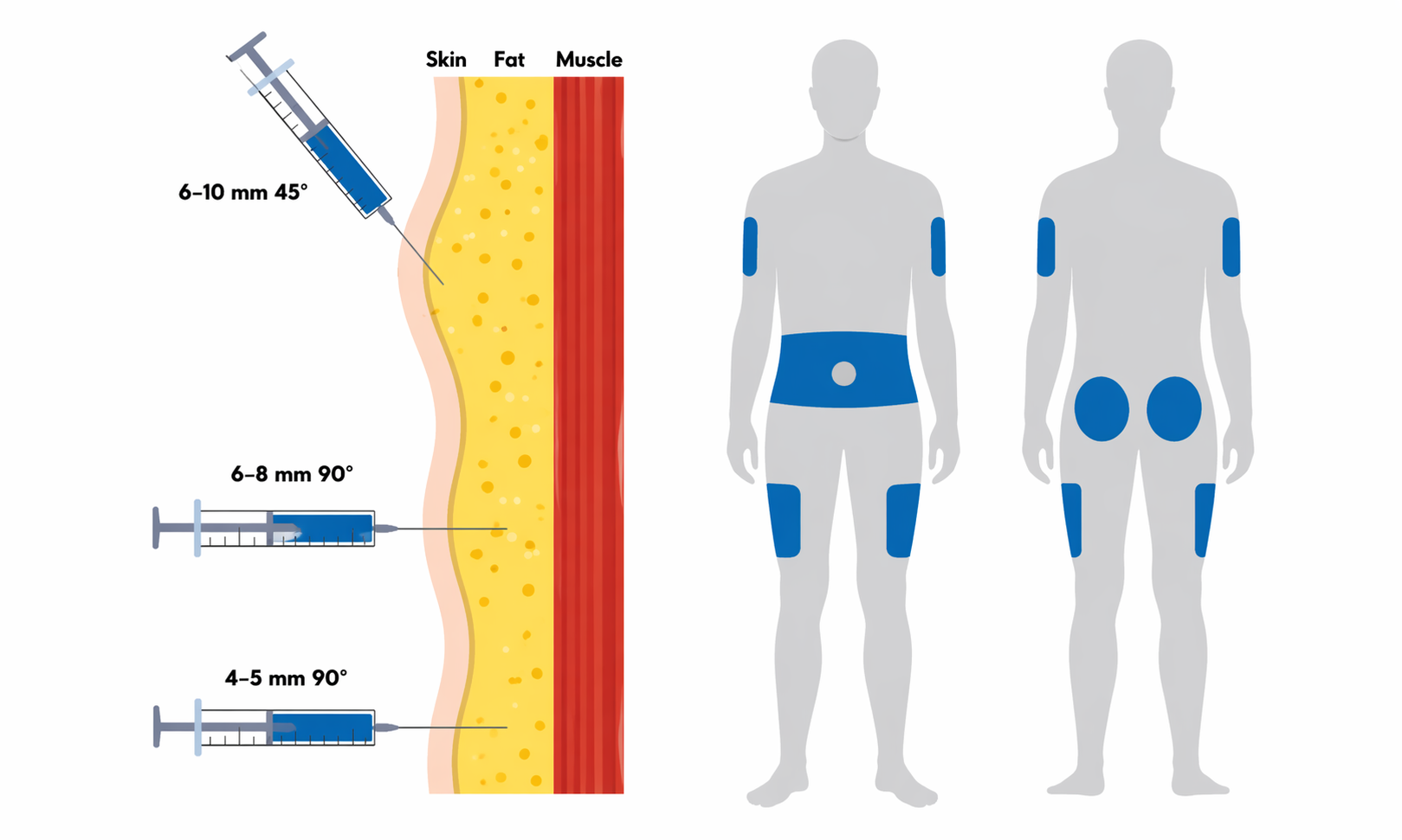 Subcutaneous injection sites diagram showing front and back view of human body with highlighted injection areas at upper arms, abdomen, and thighs